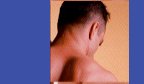 LightSheer Laser Hair Removal - for Men too!
